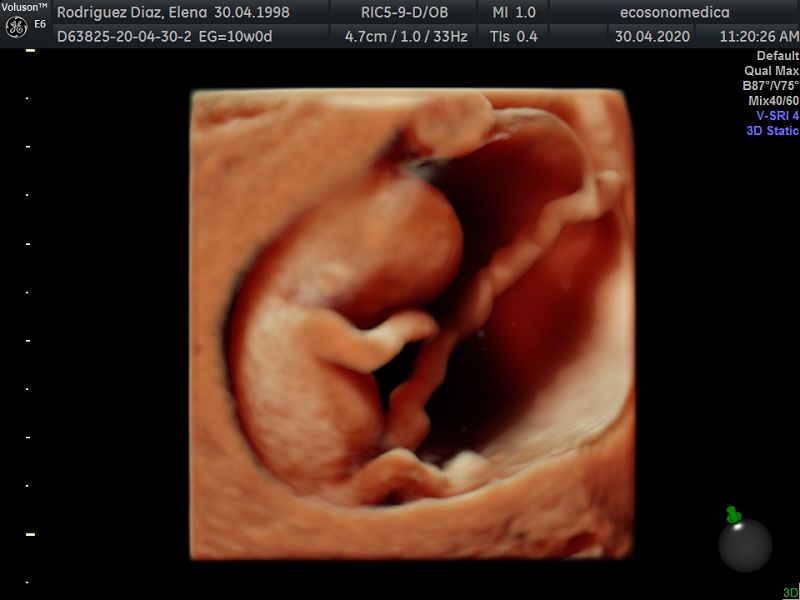 Héctor Bernardo Acevedo Manrique-5