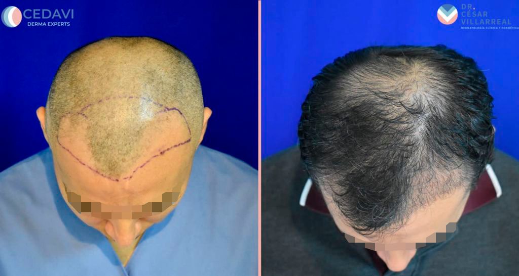 César Daniel Villarreal Villarreal-28