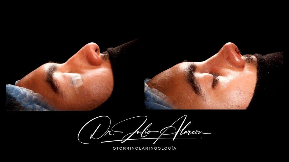 Julio César Alarcón Ortiz-6