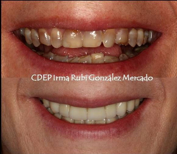 Irma Rubí González Mercado-2