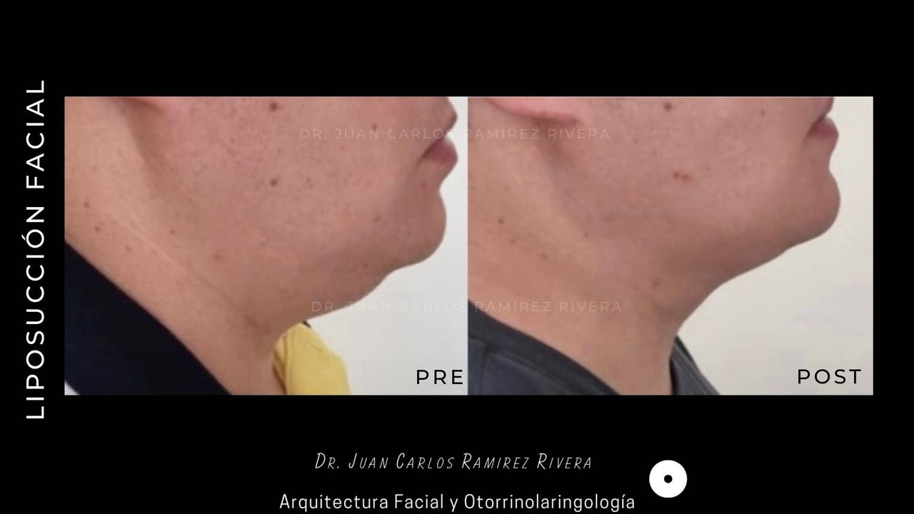 Juan Carlos Ramirez Rivera-1