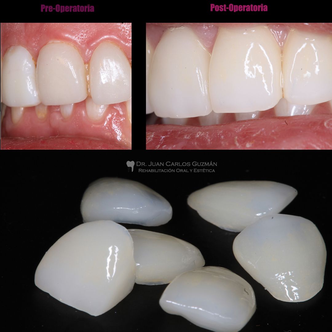 Juan Carlos Guzmán Castañeda-16