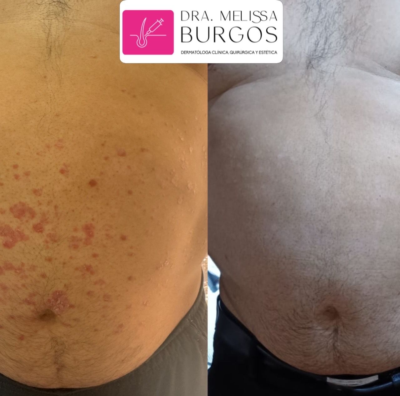 Melissa Burgos Romero-21