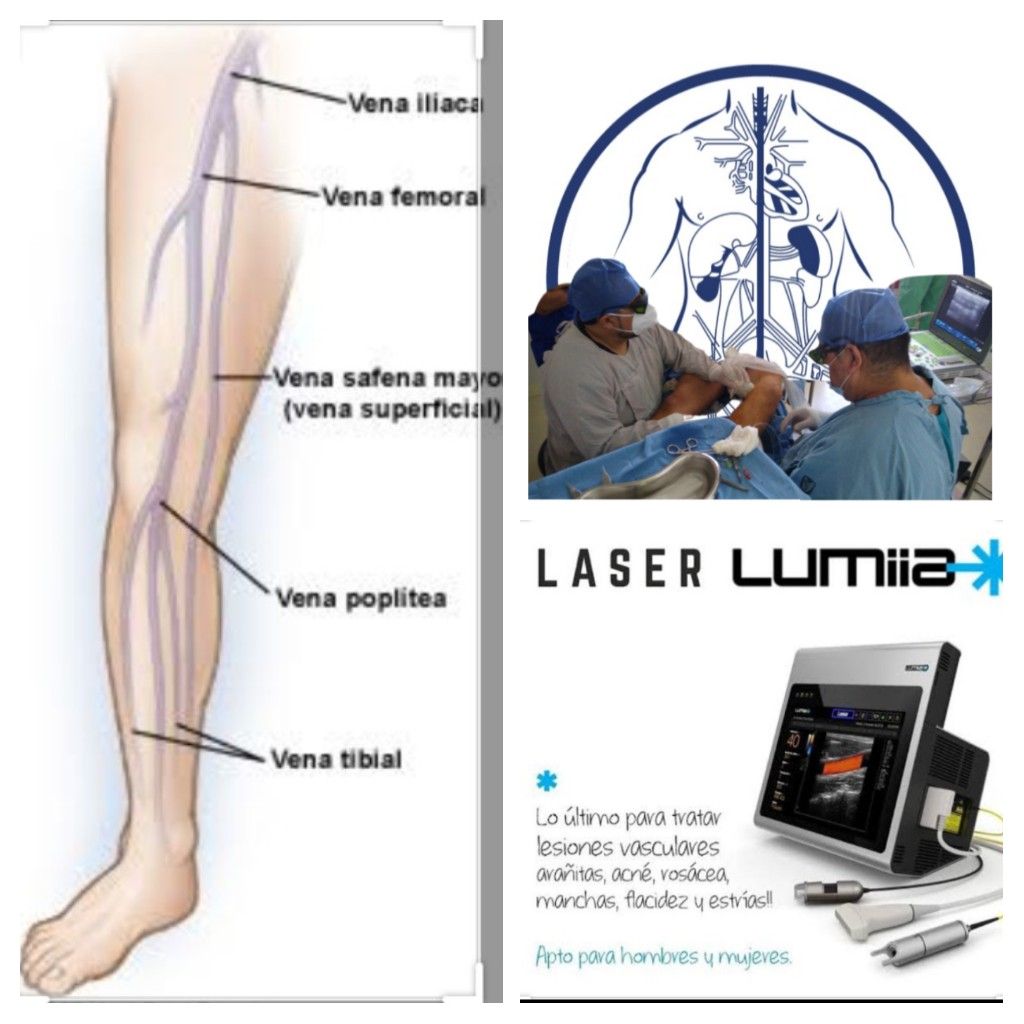 Emmanuel Hernández Luevano-16