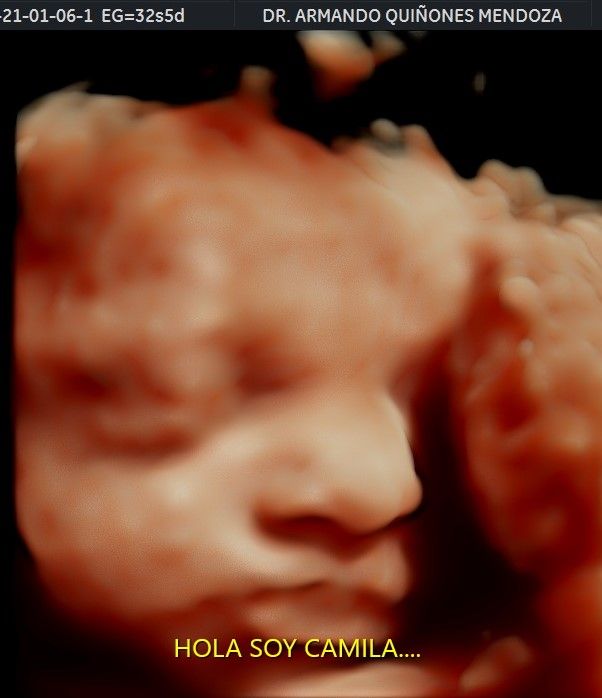 Armando Quiñones Mendoza-7