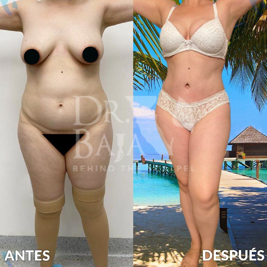 Renato Rodríguez Hirales-28