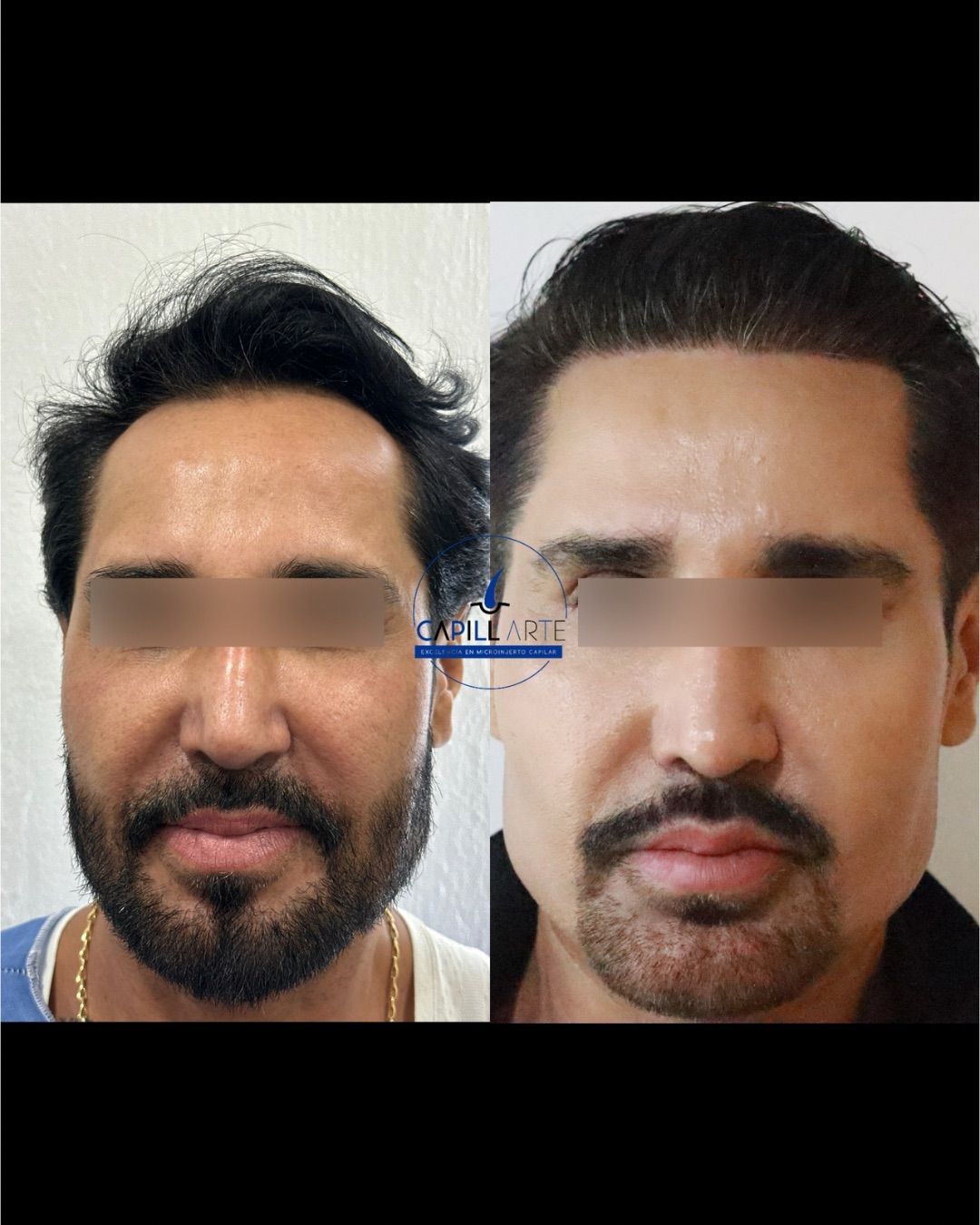 Adrian Hernandez Lopez-8