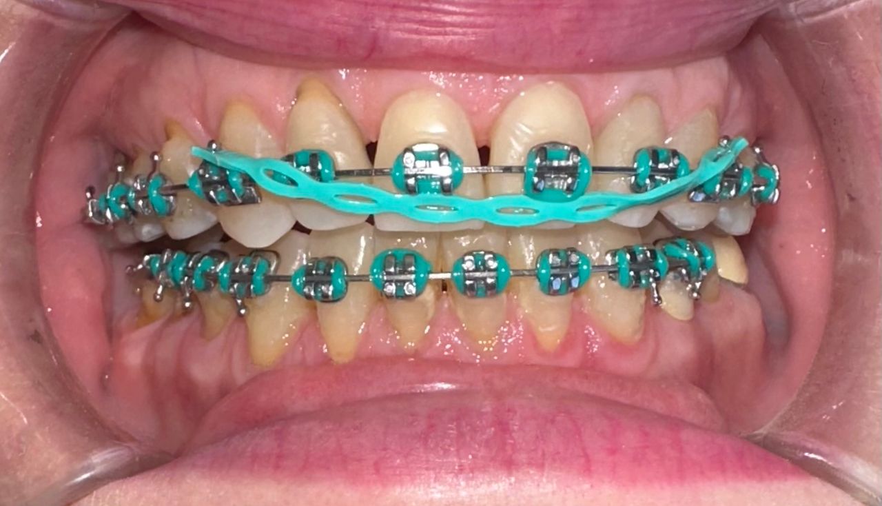 Valeria Martínez Sánchez-3