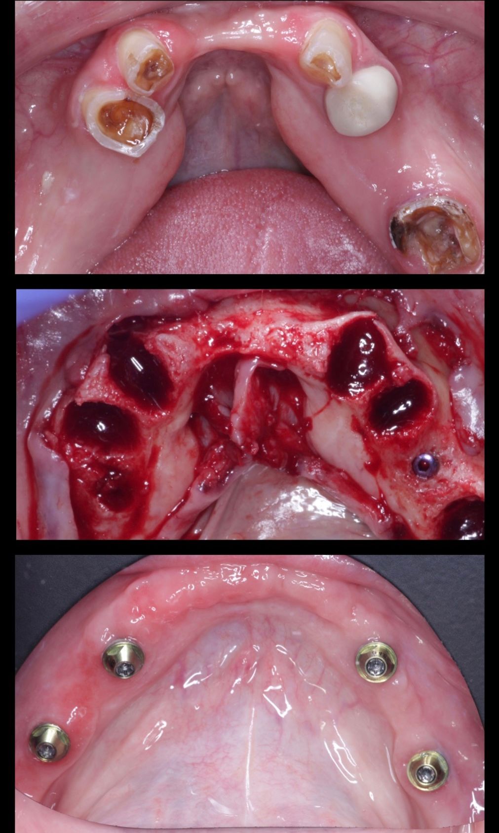 Josué Márquez Gómez-75