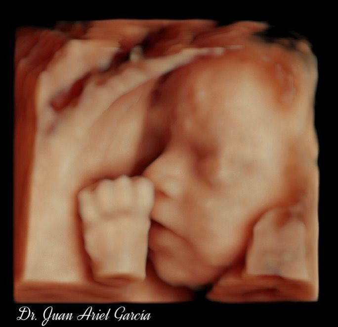 Juan Ariel Garcia Gonzalez-11