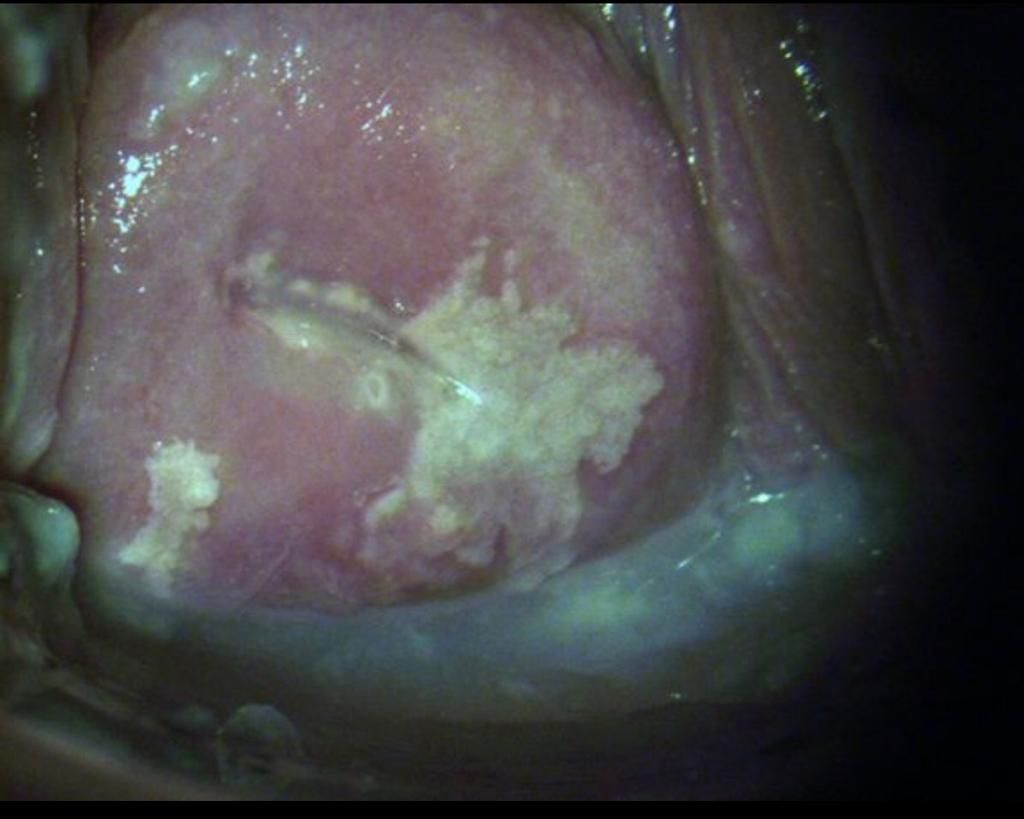 Imelda Zárate Fierro-6