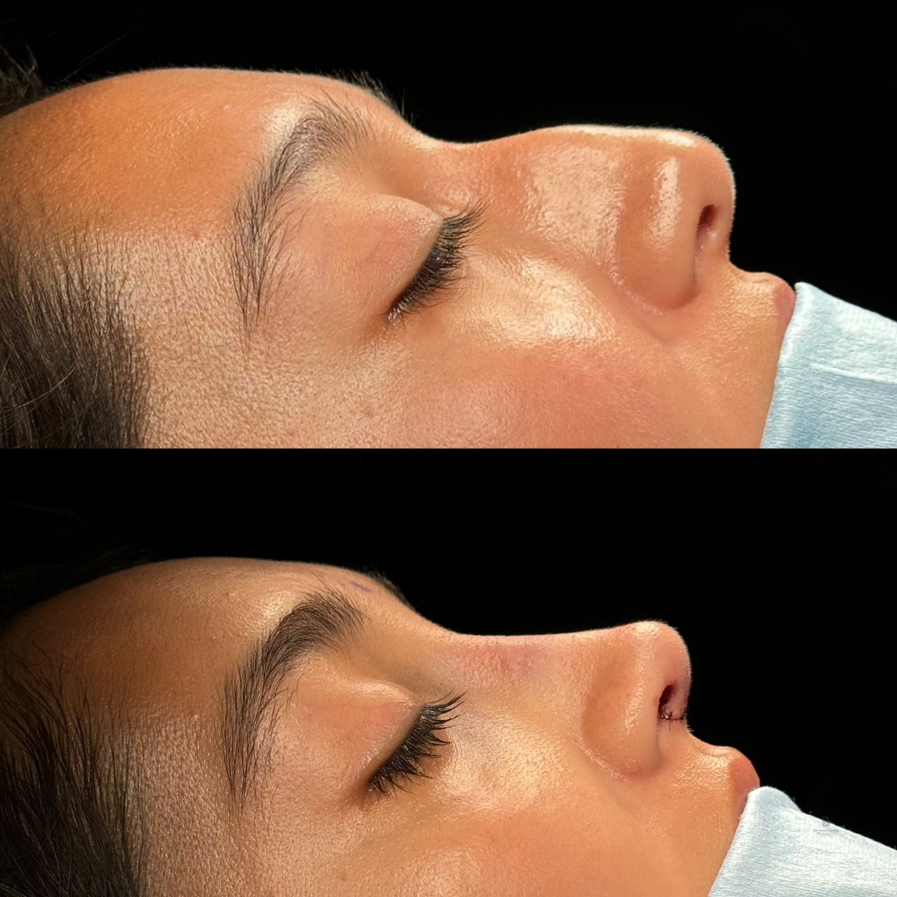 Angel Castro Urquizo-30