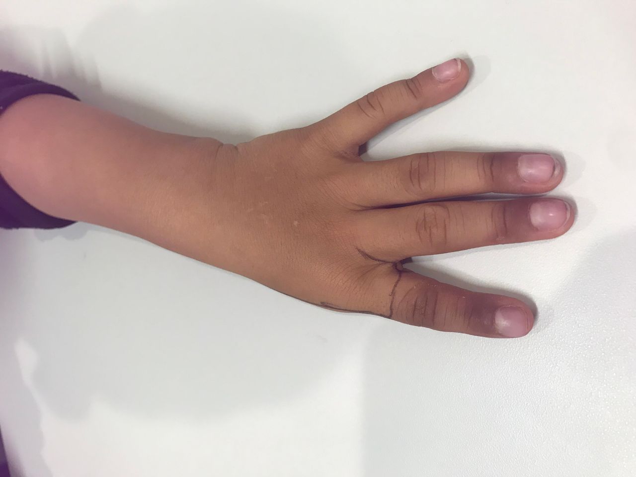 Ignacio Osvaldo Fortis Olmedo-23