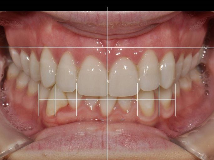 Juan Carlos Troche Chavez-9