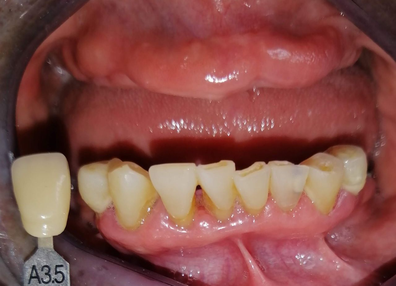 Yaneth Gutiérrez Sánchez-7