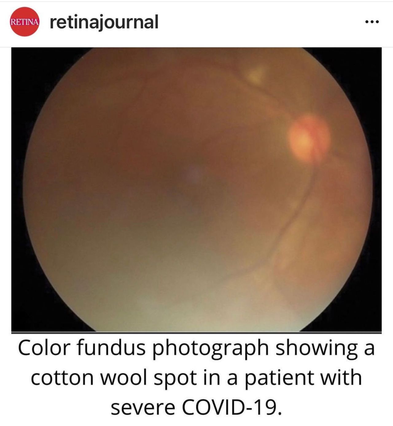 Rosa María Romero Castro-28