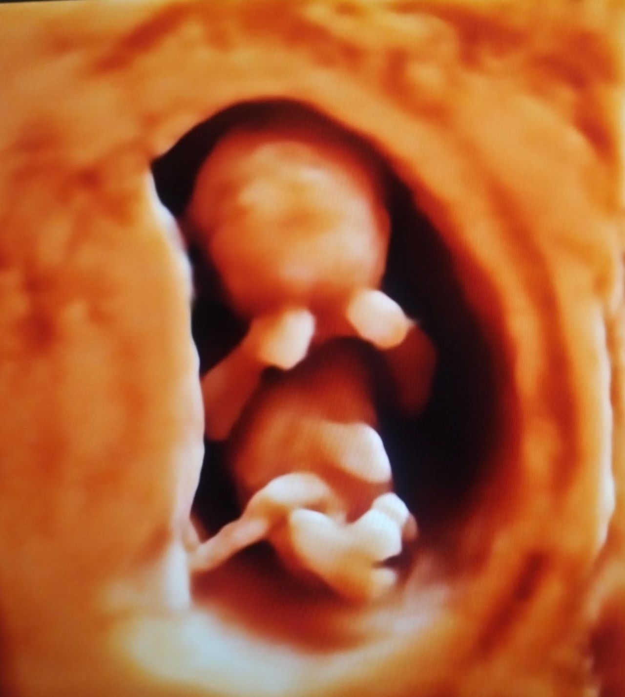 Iván André Guzmán Amador-5