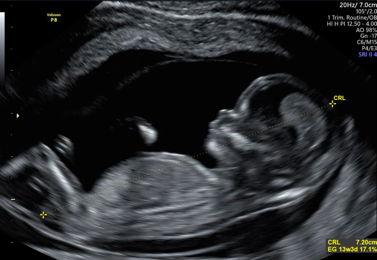 Rubí Tobón Delgado-0