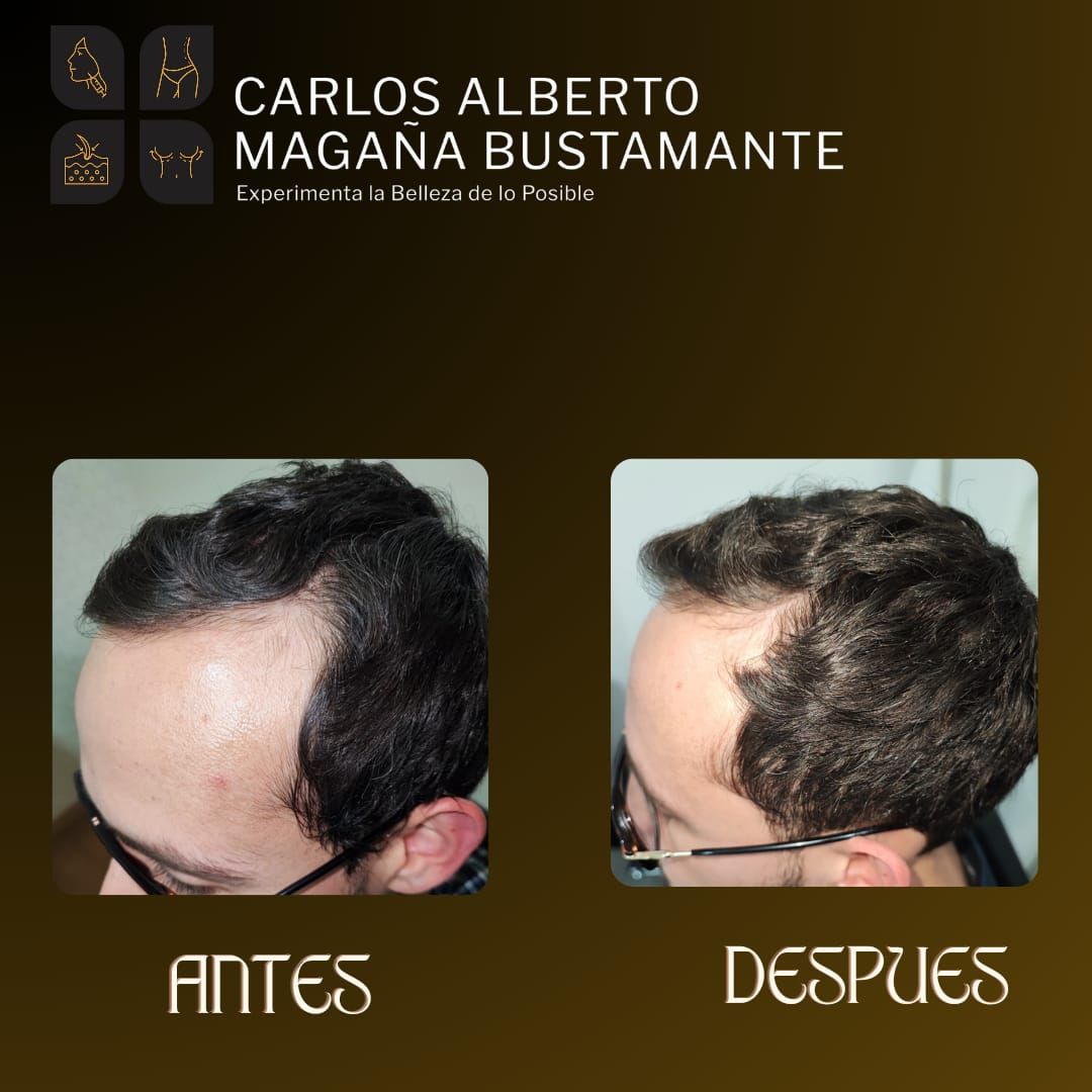 Carlos Alberto Magaña Bustamante-40