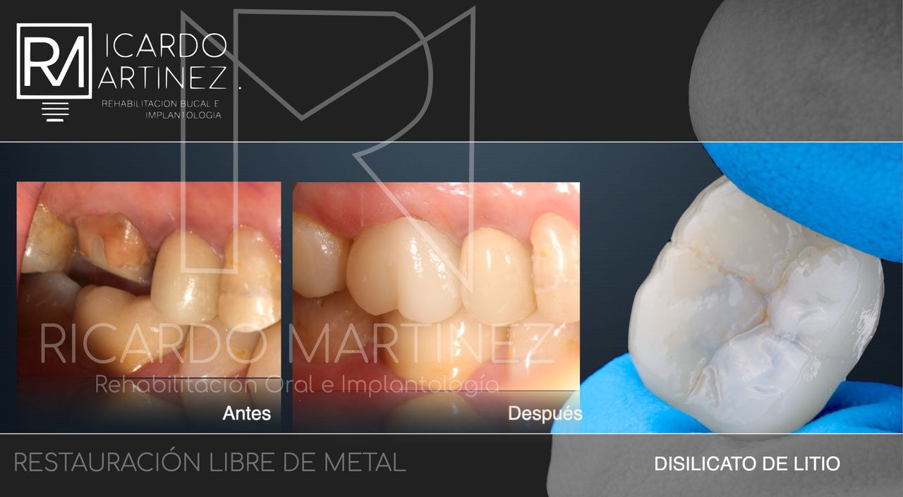 J. Ricardo Martínez-16