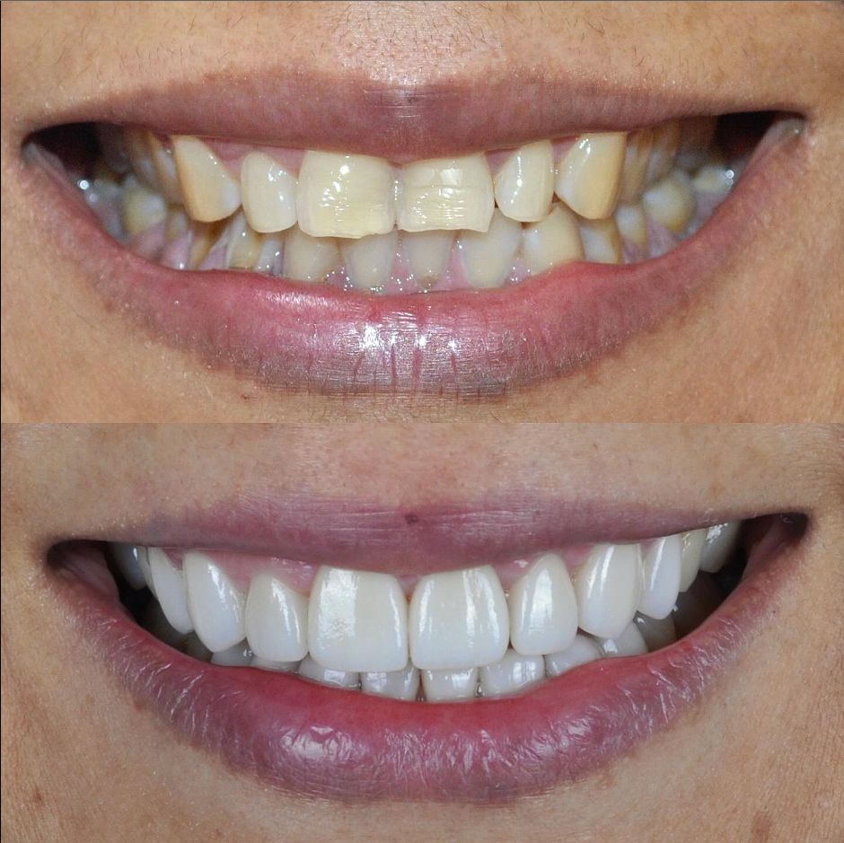 Mario Alejandro Cuellar Caraza-6