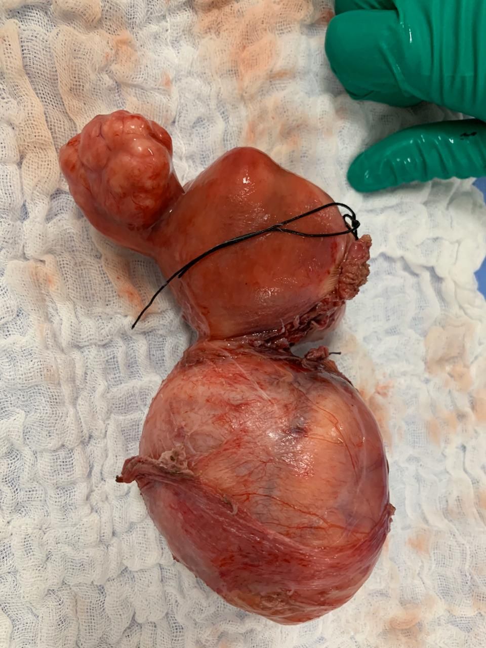 Brenda Anaid Torres Ugalde-18