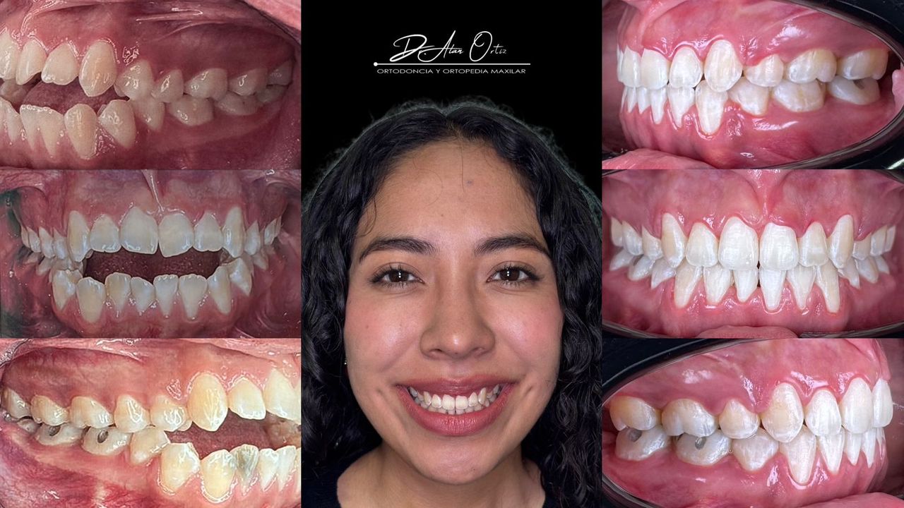 Alan Edgardo Ortiz Arenas-3