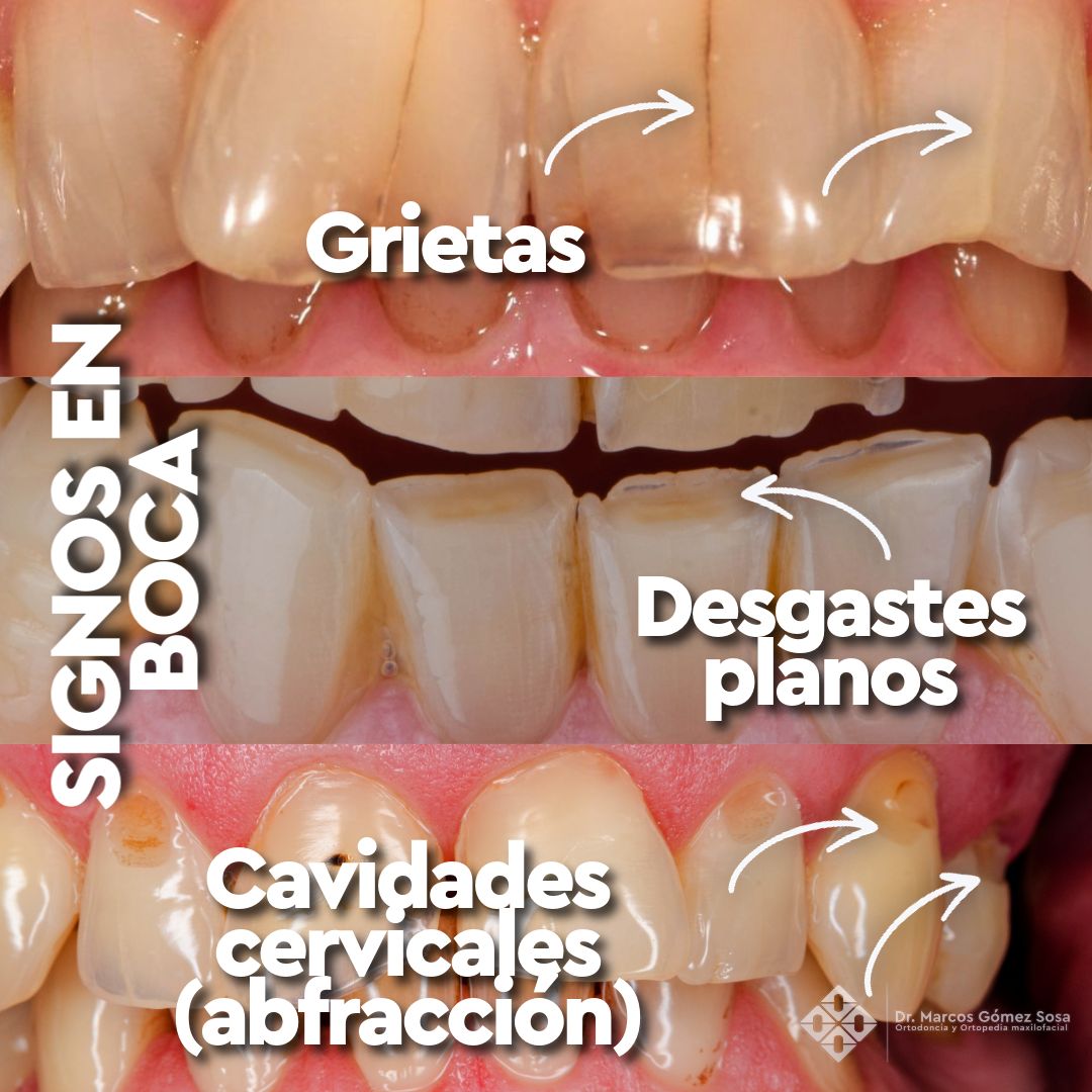 Marcos Gómez Sosa-21