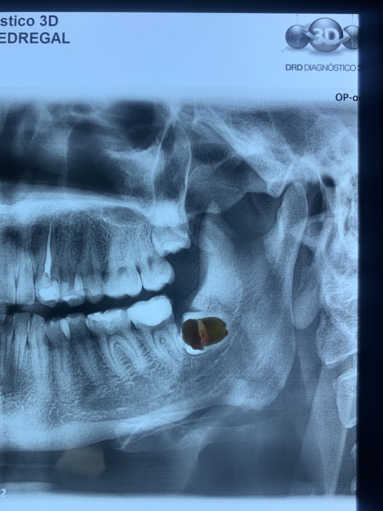 Vladimir Fernández Rojas-5