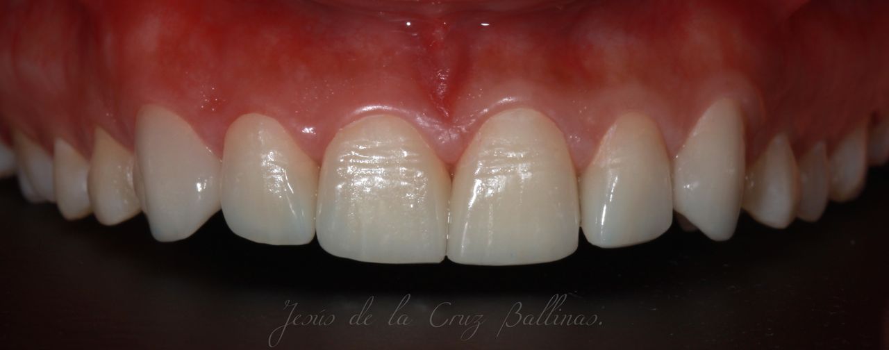 Jesus De La Cruz Ballinas-49