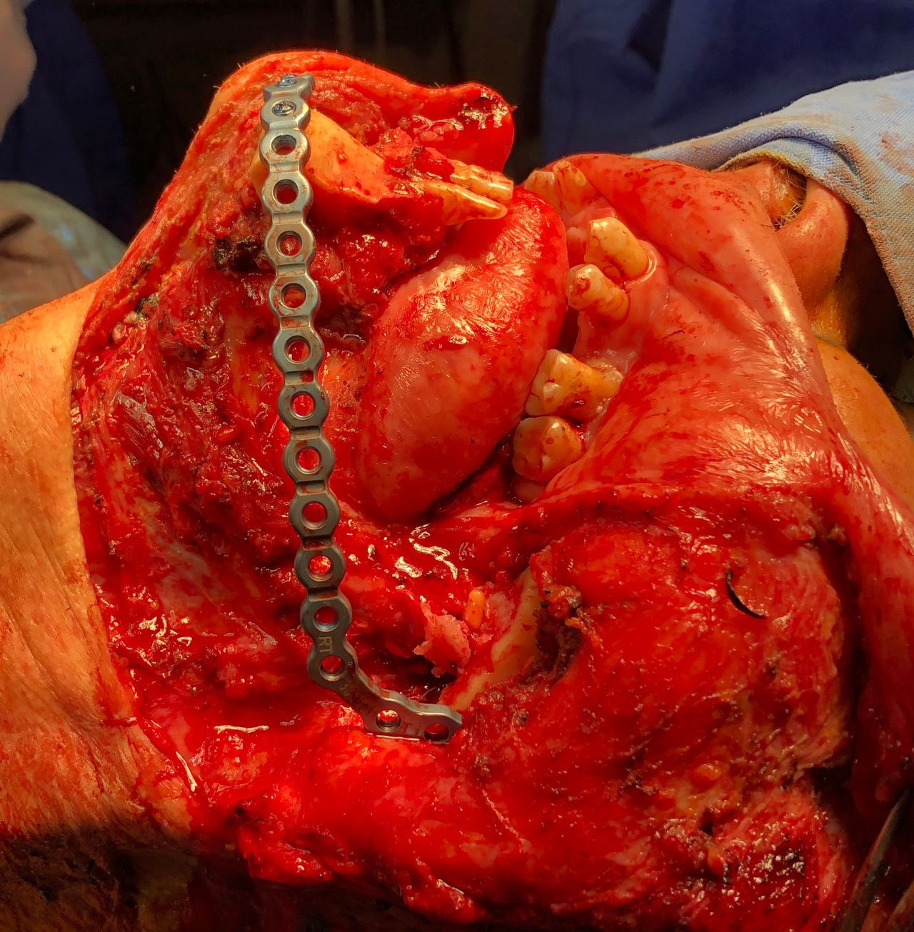 Luis Humberto Garcia Cabrera-5