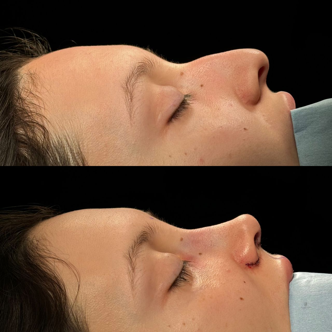 Angel Castro Urquizo-204