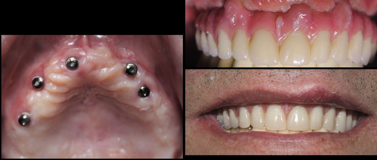 Aimee Valles Monárrez-34