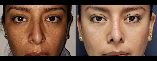 Edgar Ernesto Torres Mejía-37