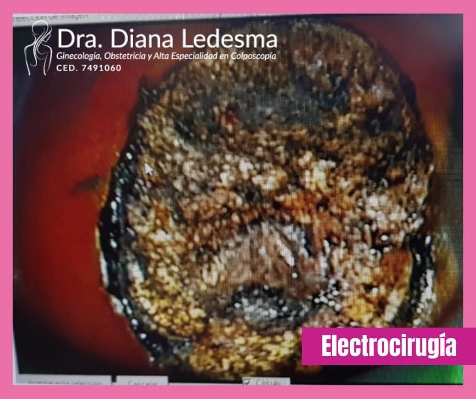 Diana Ledesma Estrada-21