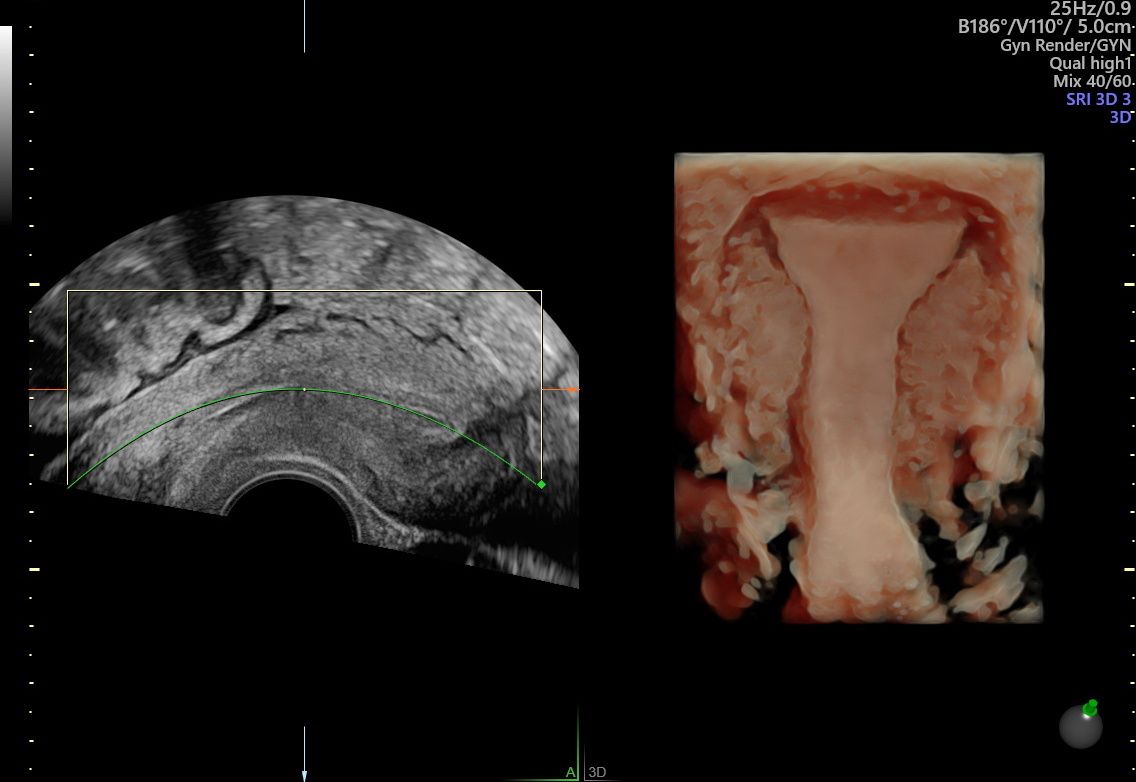 Alberto Bañuelos Peña-7