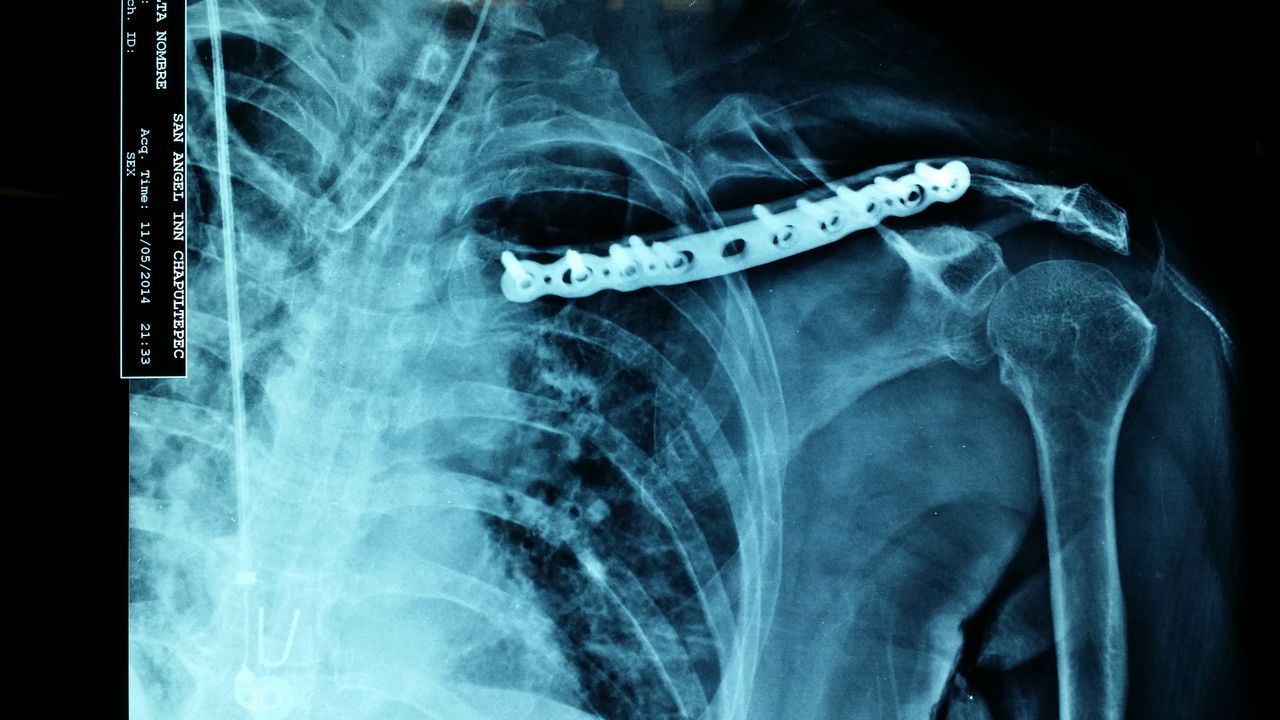 José Antonio Algarín Reyes-24