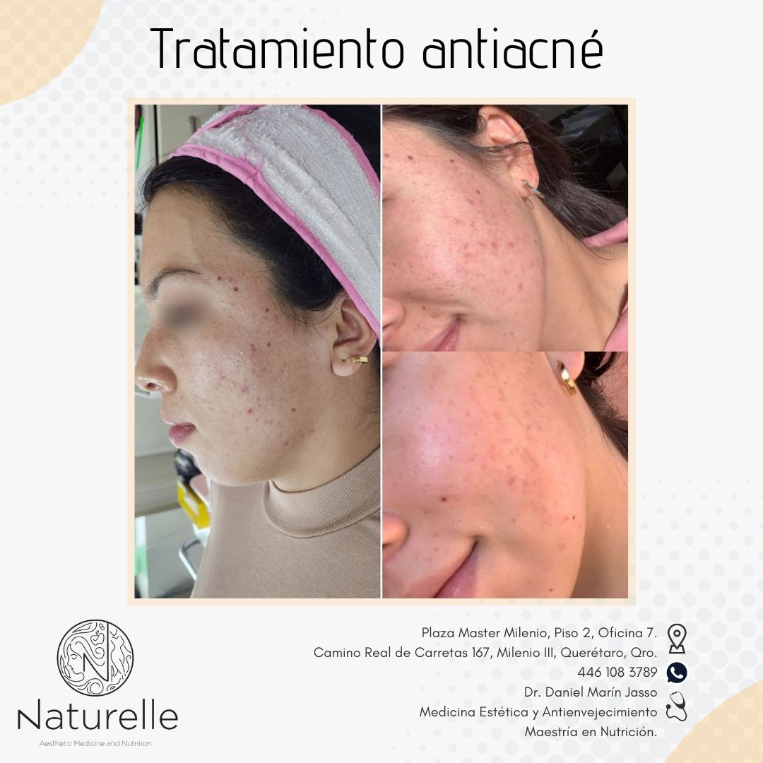 Daniel Marín Jasso-11