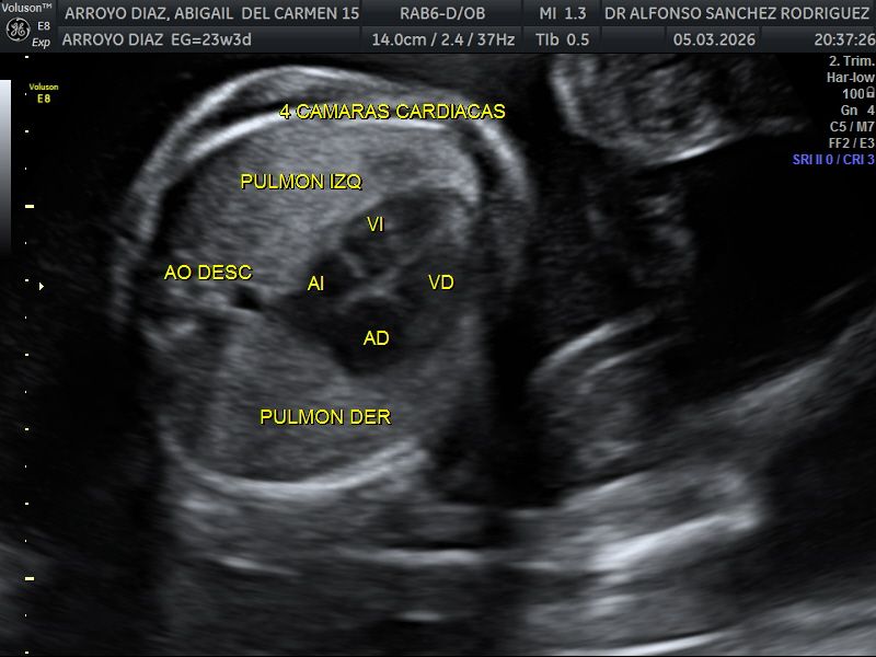 Alfonso Sanchez Rodriguez-72