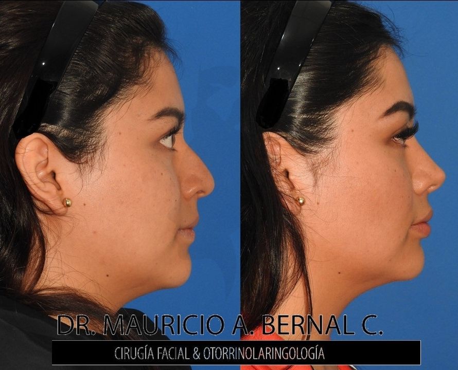 Mauricio Alejandro Bernal Carreon-19