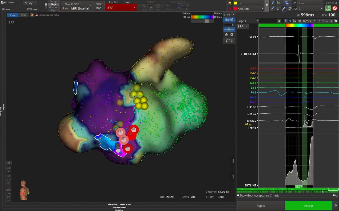 Elias Andrade Cuellar-10