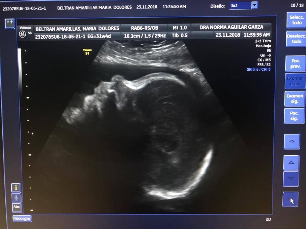 Norma Aguilar Garza-3