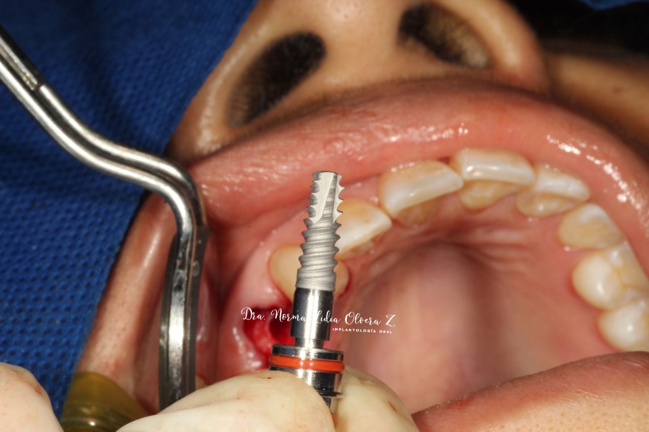 Norma Lidia Olvera Zambrano-5