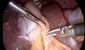 Carlos Gustavo Rivera Robledo-9