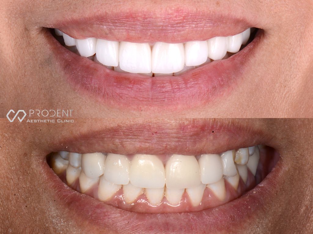 Ramiro Ivan Pérez Murillo-4