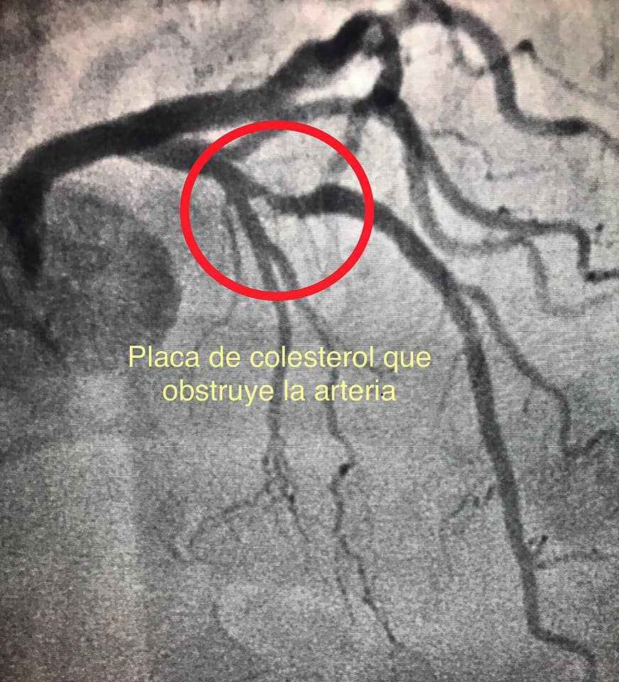 Carlos Alberto Aguirre Molina-4