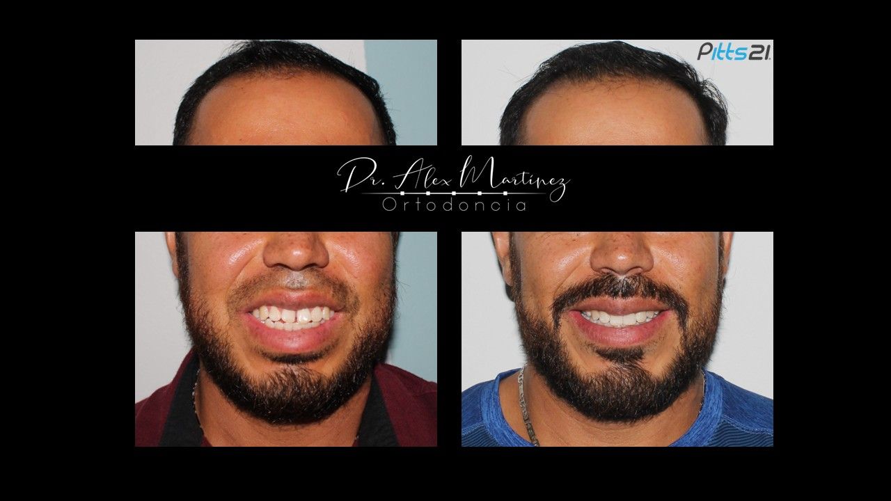 Alejandro Martínez Hernández-7