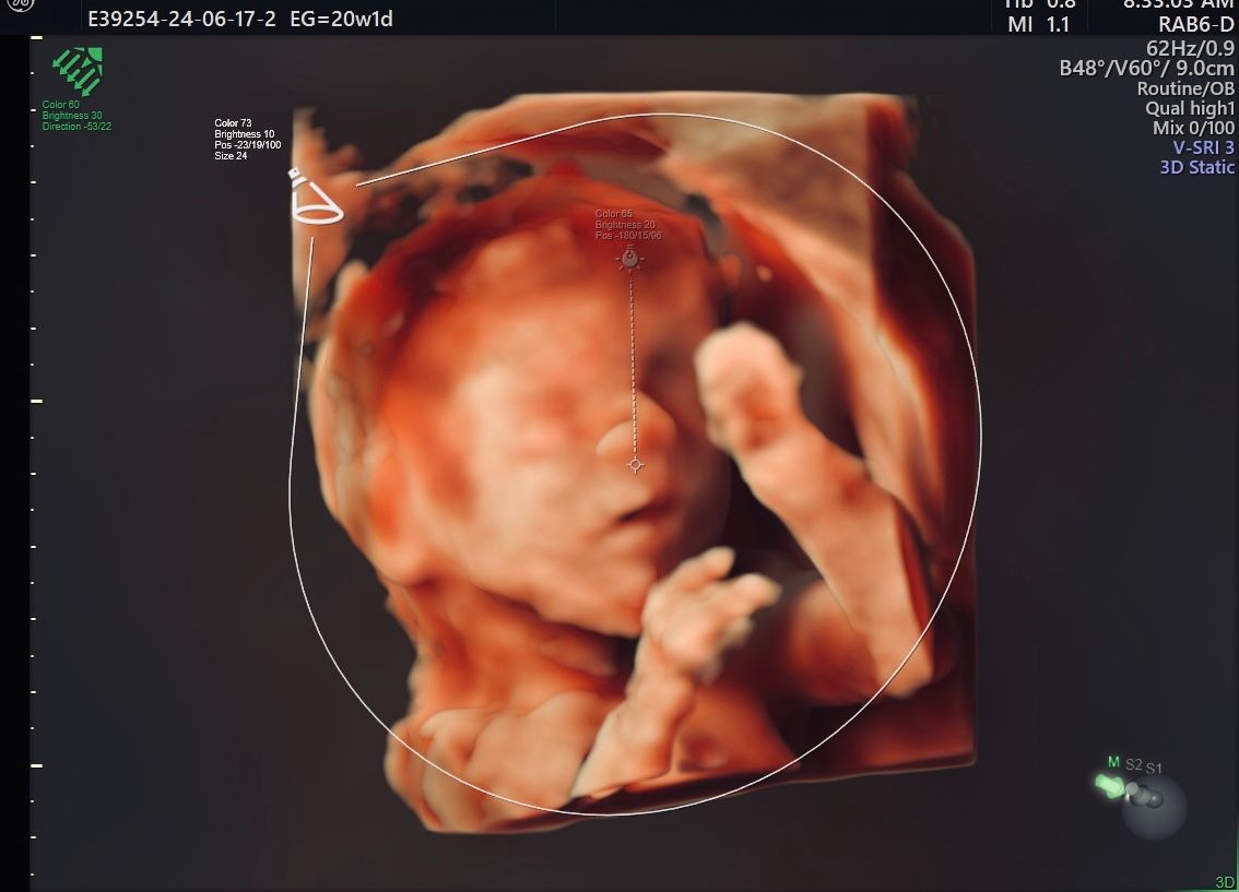 Erik Fernando González Martínez-7