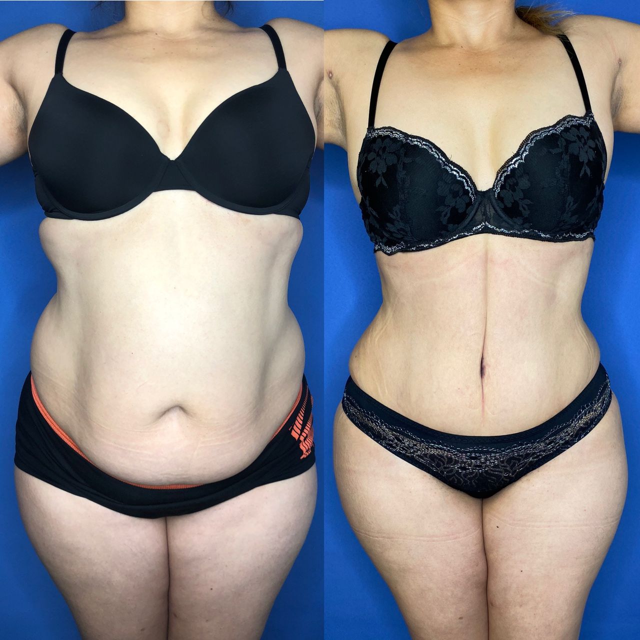 Luis Atilio Gil Pérez-0