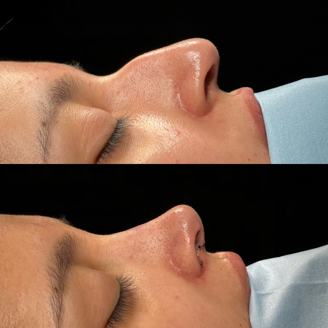 Angel Castro Urquizo-144